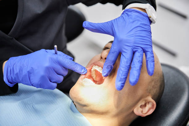Best Emergency Treatment for Dental Infections or Abscesses in Purcellville, VA